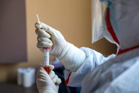 Son dəqiqə ! Azərbaycanda koronavirusdan daha bir nəfər öldü. 76 yeni yoluxma - RƏSMİ