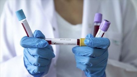 Azərbaycanda koronavirusdan daha bir nəfər öldü, 104 yeni yoluxma aşkarlandı - RƏSMİ