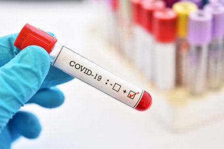 Azərbaycanda daha bir nəfər koronavirusdan öldü, 33 yeni yoluxma aşkarlandı