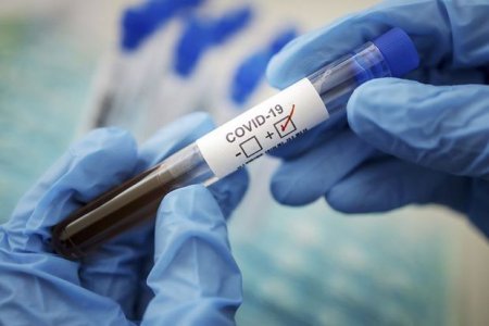 Koronavirusdan ölənlərin sayı 700 mini keçdi - STATİSTİKA
