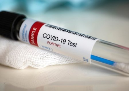 Azərbaycanda daha 169 nəfər koronavirusa yoluxub, 151-i sağalıb