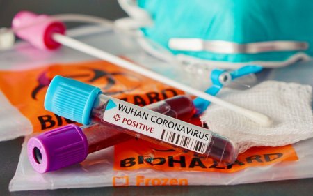 İranda son sutkada rekord sayda insan koronavirusdan ölüb