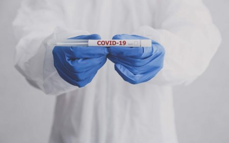 Gürcüstanda ötən sutkada 3 064 nəfər koronavirusa yoluxub