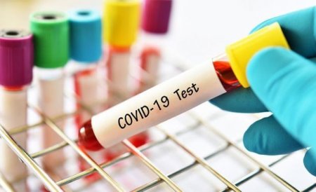 Deputat: "Koronavirus testlərinin qiyməti aşağı salınmalıdır"