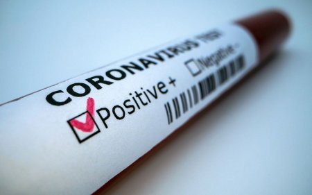 Koronavirusdan ölən jurnalistlərin sayı AÇIQLANDI