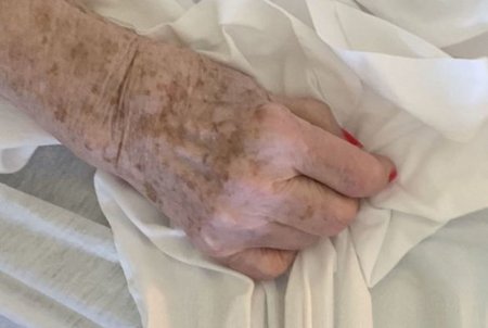 Gürcüstanda 111 yaşlı qadın koronavirusa qalib gəldi