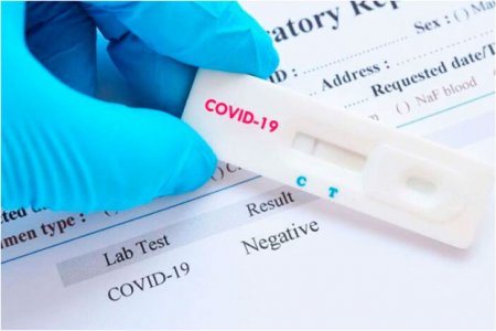 İnfeksionist: “PCR testi mənfi çıxanlar da koronaviruslu ola bilər”
