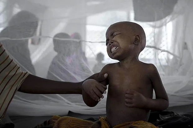 UNICEF: “Afrika ölkələrində vəba epidemiyası sürətlə yayılır”