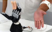 Protezin bütün barmaqlarını idarə etməyə imkan verən bionik implant yaradılıb